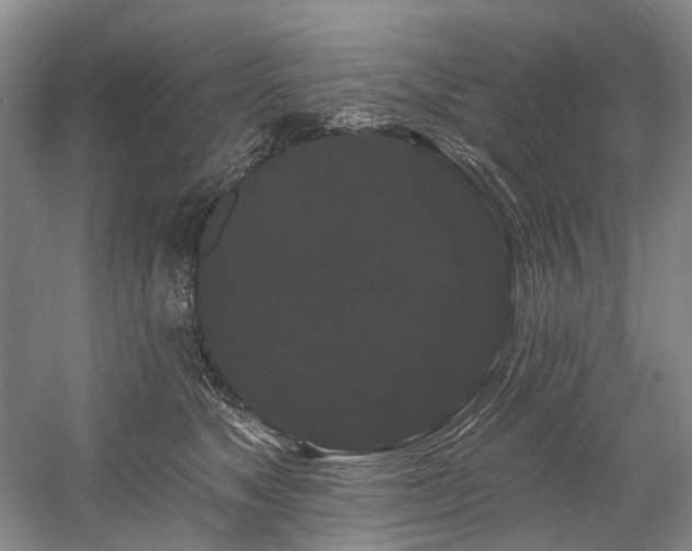 X0000058770517200509301047