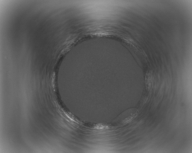 X0000058770760200509301044