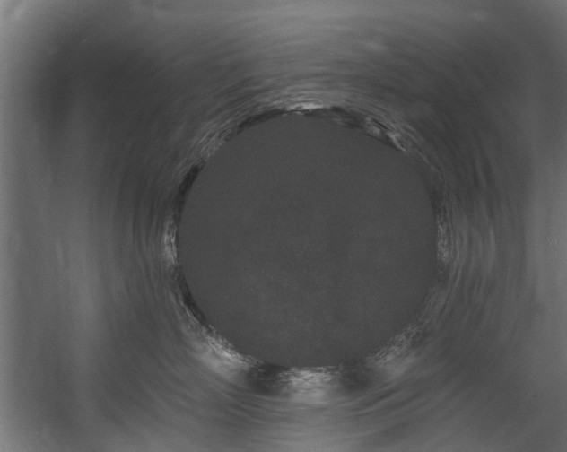 X0000058770718200510031045