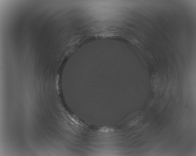 X0000058770760200510031045