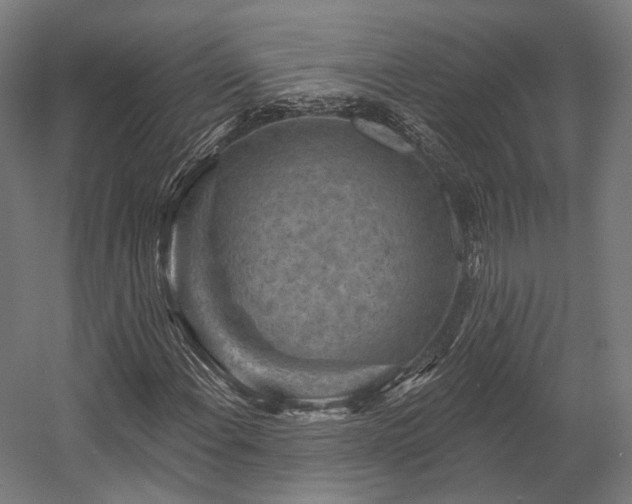 X0000058771108200510031038