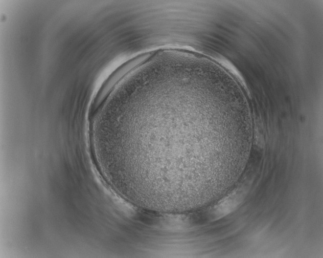 X0000058781096200510031014