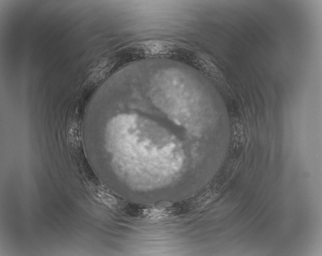 X0000058780419200510171258