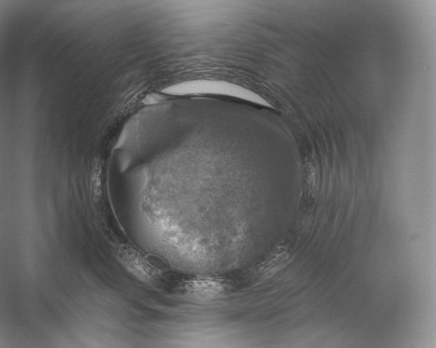 X0000058780668200510171255