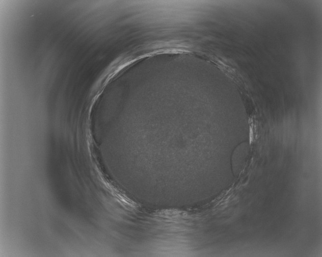 X0000058810339200509301239