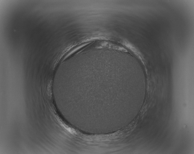 X0000058810009200510031359