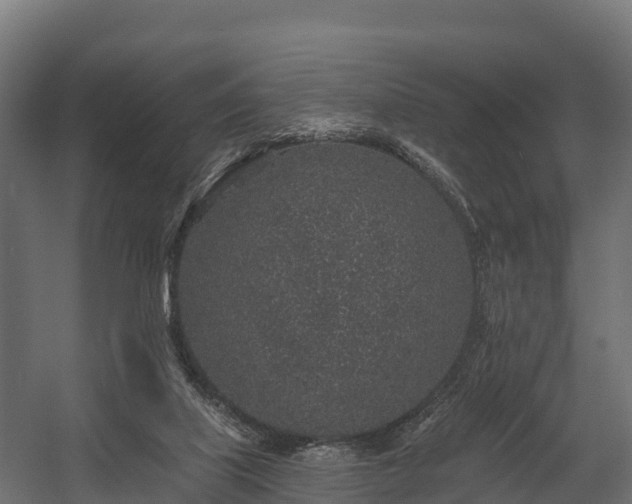 X0000058810067200510031358