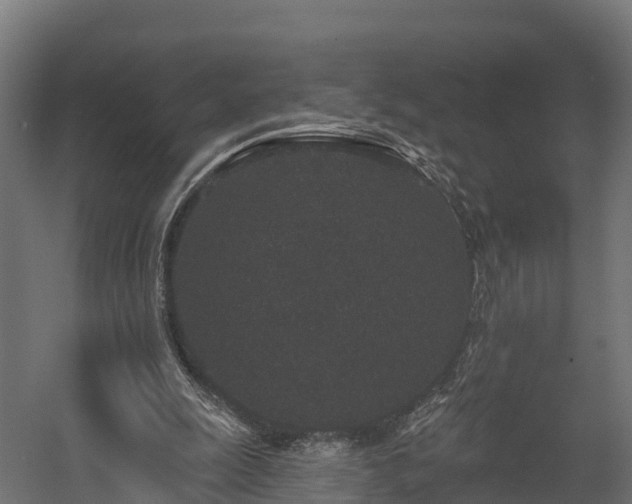 X0000058810247200510031354