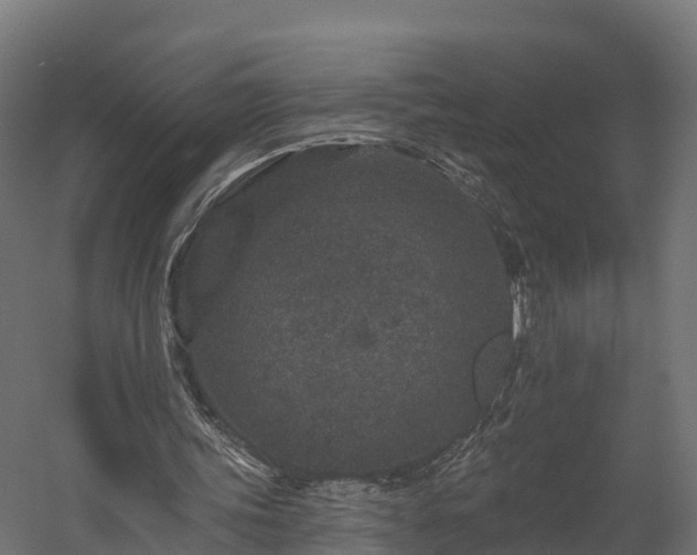 X0000058810339200510031352