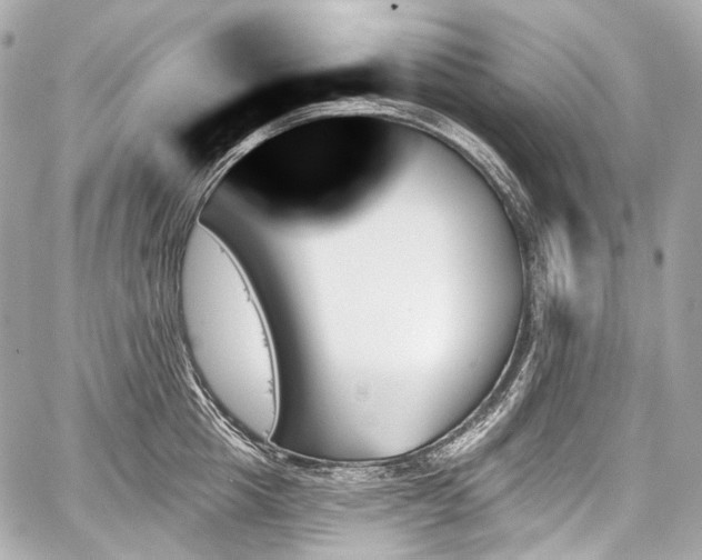 X0000059060857200510101047