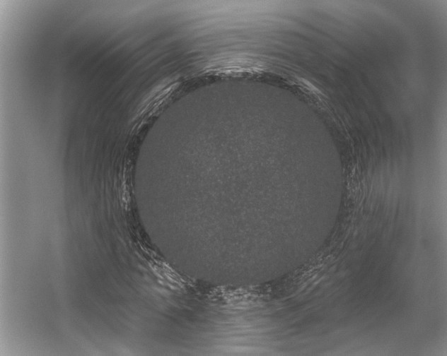 X0000059100774200510071143