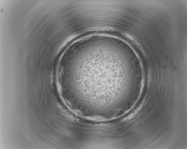 X0000059101017200510172114