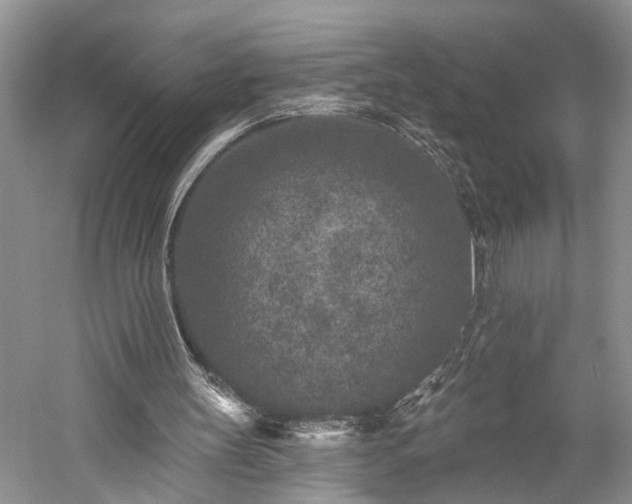 X0000059220147200510171433