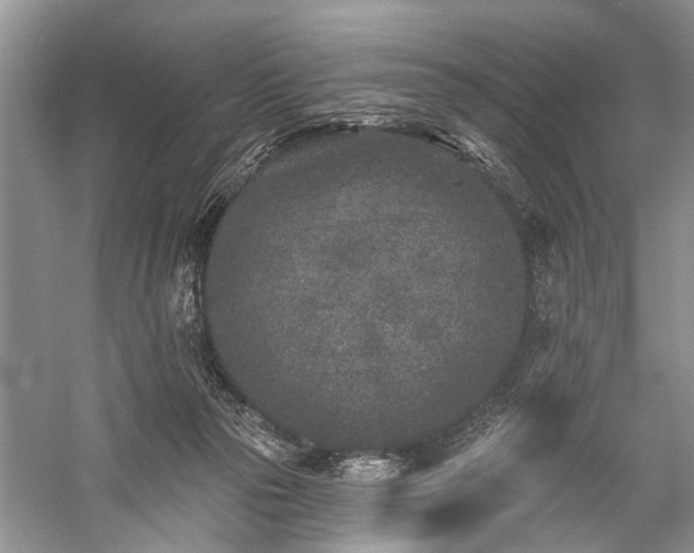 X0000059220169200510171433