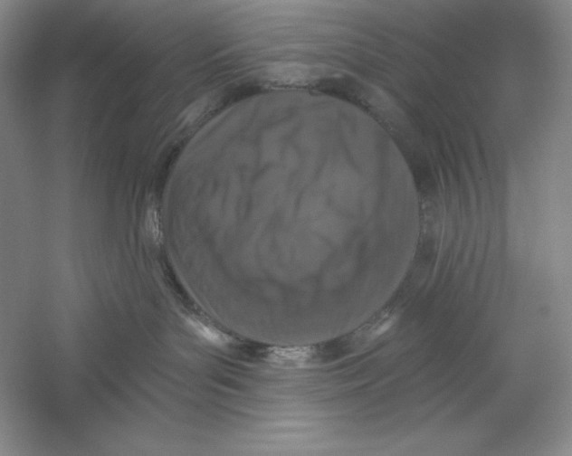 X0000059220143200511111532