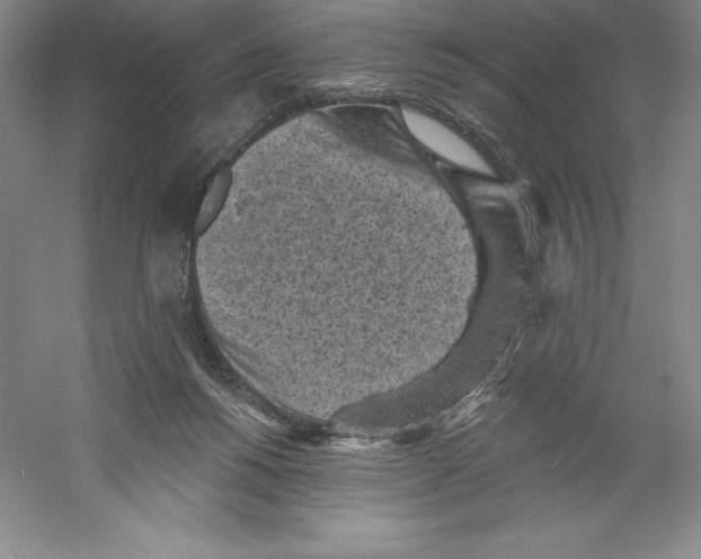 X0000059220168200511111531
