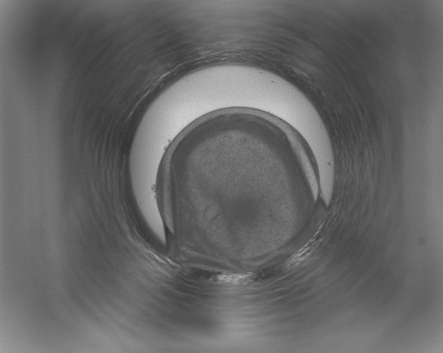 X0000059220172200511111531