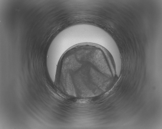 X0000059220175200511111531
