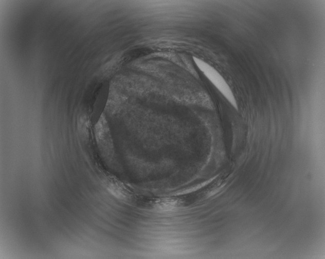 X0000059220235200511111530