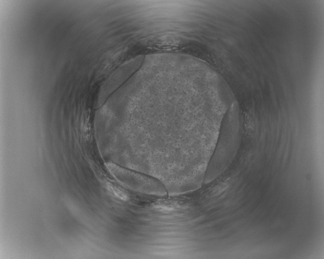 X0000059220818200511111519