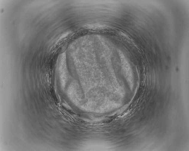 X0000059250966200511041329