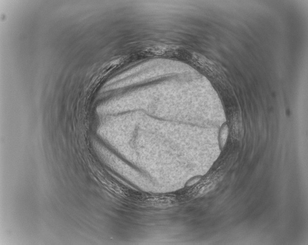 X0000059251105200511041326