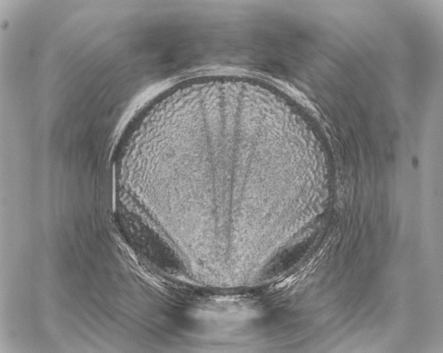 X0000059251223200511041325