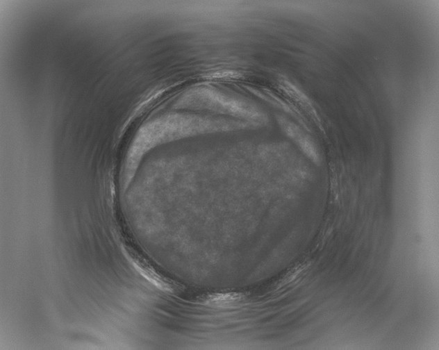 X0000059250059200511111652