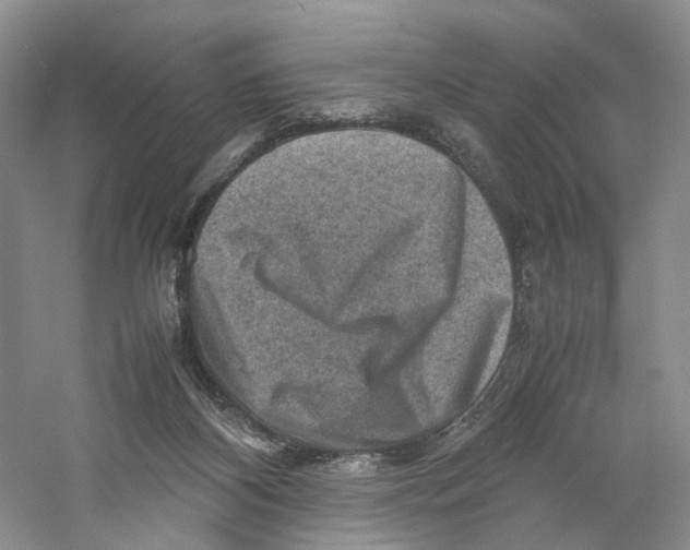 X0000059250116200511111651