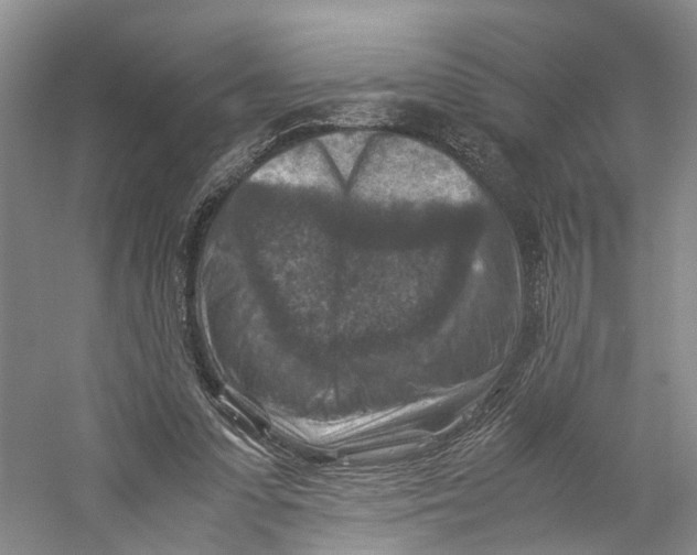 X0000059250303200511111648