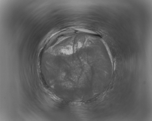 X0000059250339200511111647