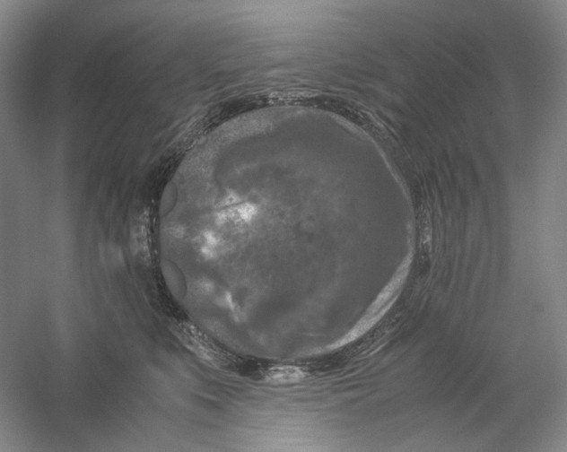 X0000059250519200511111644