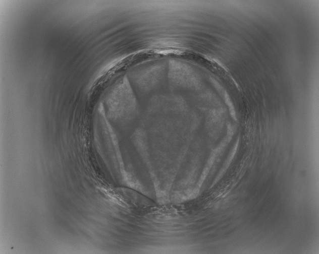 X0000059250919200511111637