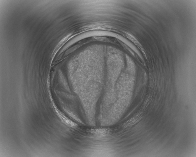 X0000059250946200511111637