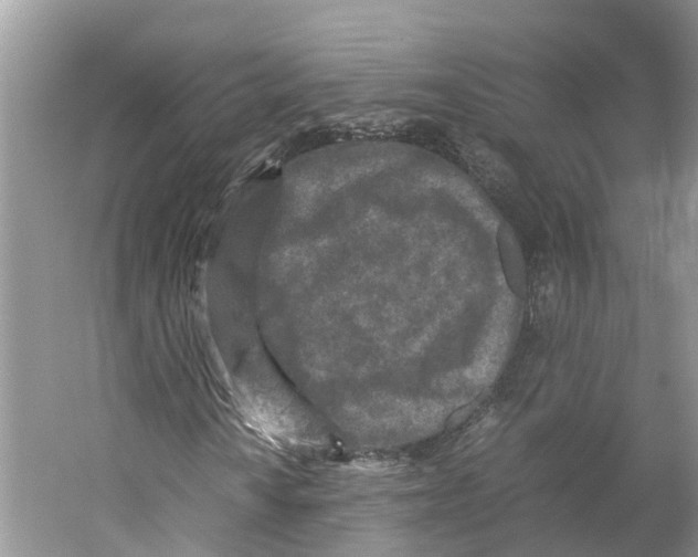 X0000059251010200511111635