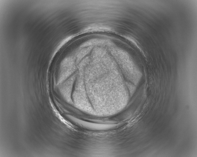 X0000059251038200511111636