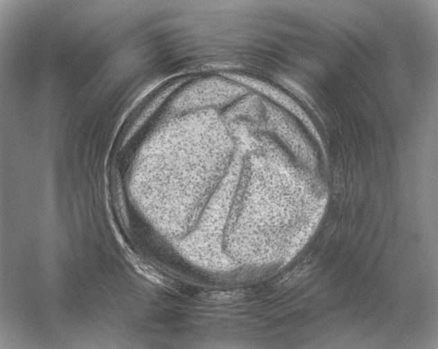 X0000059251047200511111636