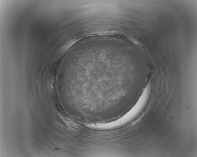 X0000059251161200511111633