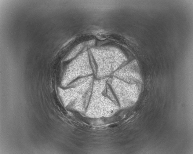 X0000059251205200511111632