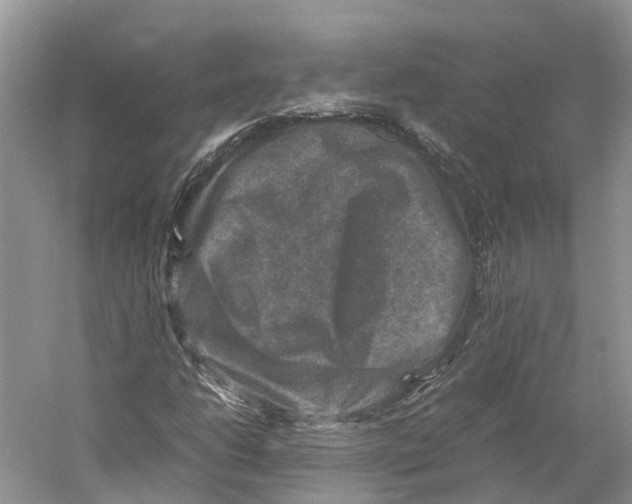 X0000059251206200511111632