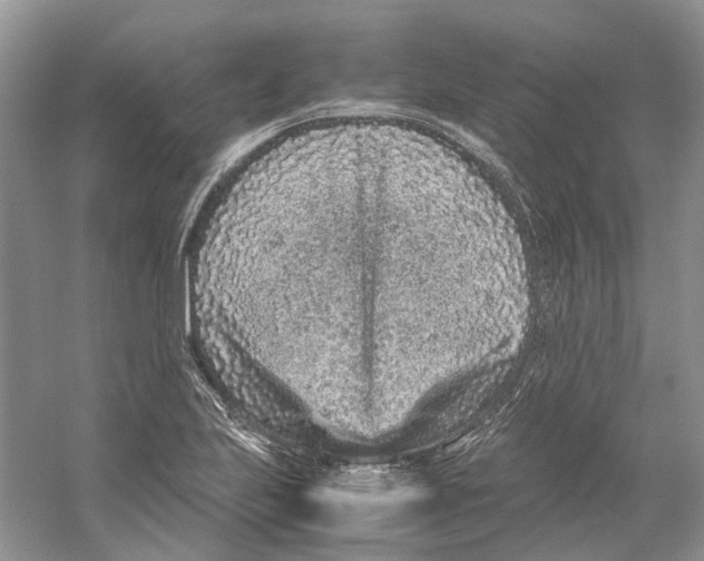 X0000059251223200511111632