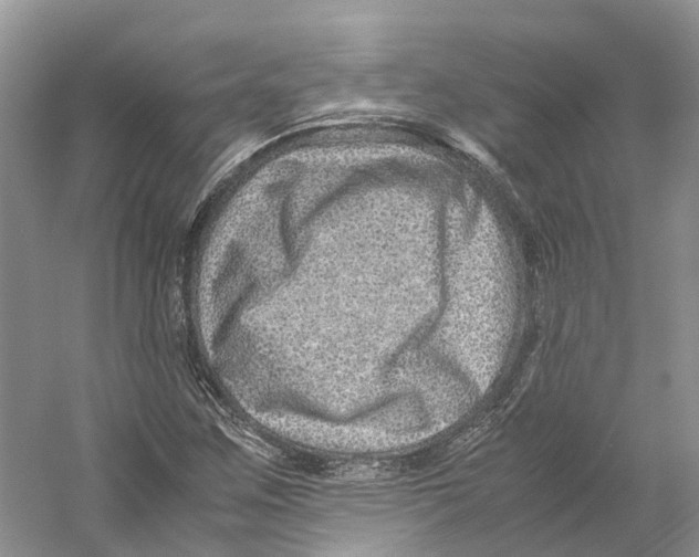 X0000059251259200511111632