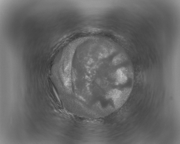 X0000059251397200511111629