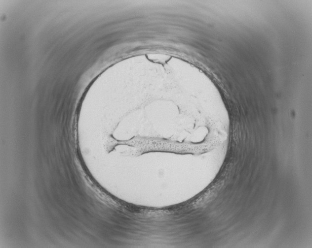 X0000059831522200511181435