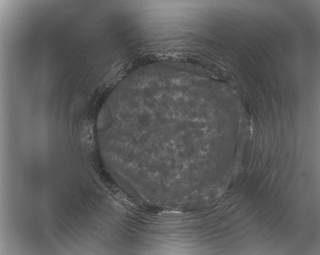 X0000059840699200511041813