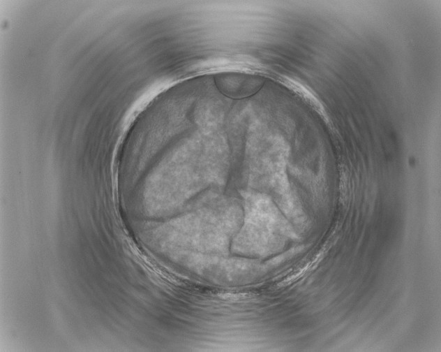 X0000059841419200511181501