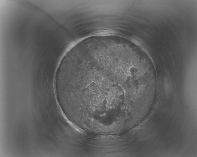 X0000059851429200511041828