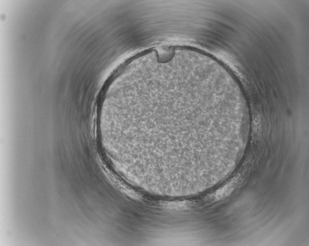 X0000059851126200511111804