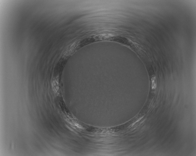 X0000060221011200510311515