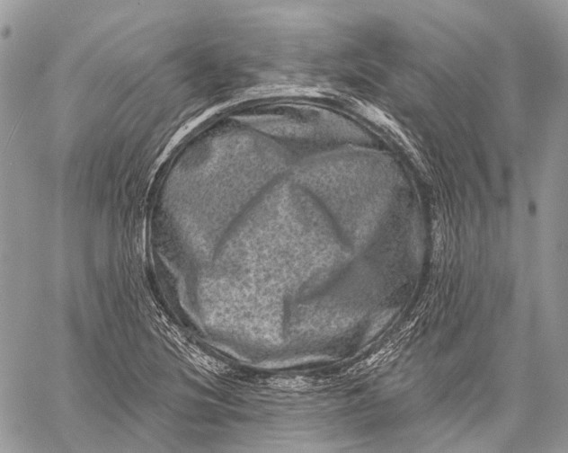 X0000060221220200511181204